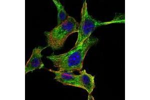 Immunofluorescence analysis of NIH/3T3 cells using CHUK antibody (green). (IKK alpha Antikörper)
