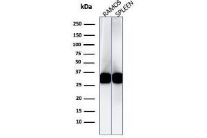 Western Blotting (WB) image for anti-Major Histocompatibility Complex, Class II, DR beta 1 (HLA-DRB1) antibody (ABIN6939640)
