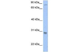 WB Suggested Anti-GSTT1 Antibody Titration:  0.