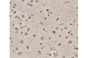 Immunohistochemistry of paraffin-embedded Rat brain using MonoMethyl-Histone H3-K36 Polyclonal Antibody at dilution of 1:200 (40x lens).