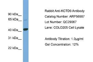 WB Suggested Anti-KCTD9  Antibody Titration: 0. (KCTD9 Antikörper  (Middle Region))