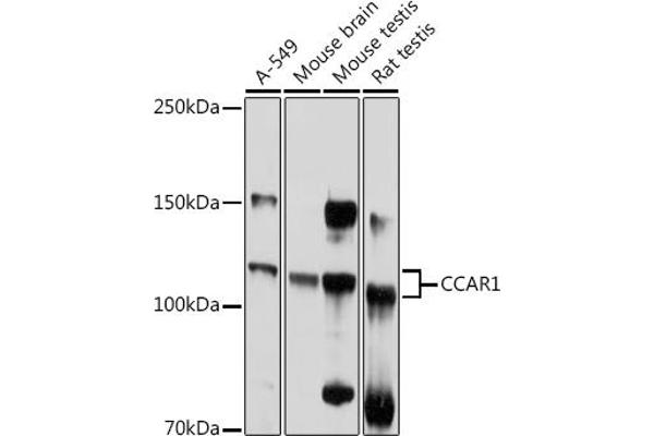 CCAR1 抗体  (AA 1-200)
