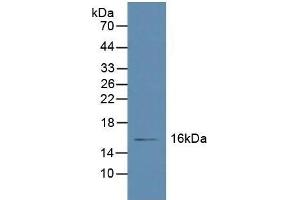 Detection of RBP5 in Human Liver Tissue using Polyclonal Antibody to Retinol Binding Protein 5, Cellular (RBP5) (Retinol Binding Protein 5 Antikörper  (AA 2-135))