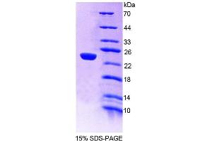 SDS-PAGE (SDS) image for Glucosidase, Alpha, Acid (GAA) (AA 70-245) protein (His tag) (ABIN6237680)