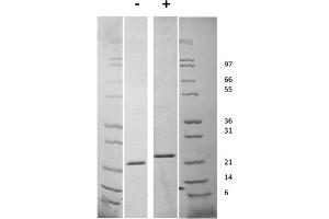 SDS-PAGE of Human Fibroblast Growth Factor-21 Recombinant Protein SDS-PAGE of Human Fibroblast Growth Factor-21 Recombinant Protein. (FGF21 Protein)