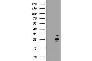 Image no. 1 for anti-RAB37, Member RAS Oncogene Family (RAB37) antibody (ABIN1500566) (RAB37 Antikörper)