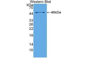 Detection of Recombinant LpPLA2, Mouse using Polyclonal Antibody to Phospholipase A2 Group VII (LpPLA2) (PLA2G7 Antikörper  (AA 22-440))