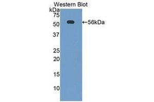 Western Blotting (WB) image for anti-CD46 (CD46) (AA 157-365) antibody (ABIN1859778) (CD46 Antikörper  (AA 157-365))