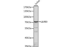 Western blot analysis of extracts of Jurkat cells, using LILRB3 antibody (ABIN7268239) at 1:1000 dilution. (LILRB3 Antikörper  (AA 400-500))
