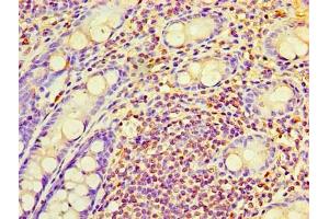 Immunohistochemistry of paraffin-embedded human colon tissue using ABIN7167365 at dilution of 1:100