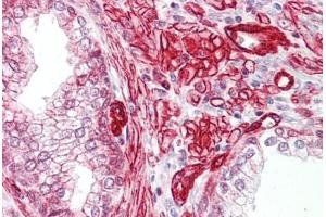 Anti-GAB2 antibody IHC staining of human prostate. (GAB2 Antikörper  (AA 125-174))