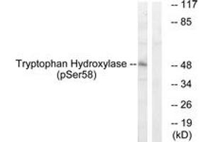 Western blot analysis of extracts from 293 cells treated with paclitaxel 1uM 24h, using Tryptophan Hydroxylase (Phospho-Ser58) Antibody. (Tryptophan Hydroxylase 1 Antikörper  (pSer58))