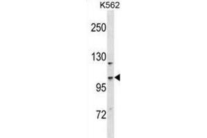 Western Blotting (WB) image for anti-Coiled-Coil and C2 Domain Containing 1A (CC2D1A) antibody (ABIN2998622) (CC2D1A Antikörper)