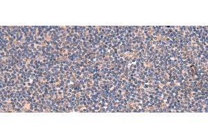 Immunohistochemistry of paraffin-embedded Human tonsil tissue using GALK2 Polyclonal Antibody at dilution of 1:95(x200)
