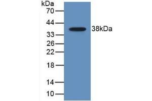 Detection of Recombinant MDC, Human using Monoclonal Antibody to Macrophage Derived Chemokine (MDC)