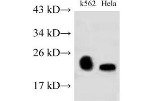 Western Blot analysis of K562 and Hela cells using RAB9A Polyclonal Antibody at dilution of 1:500 (RAB9A Antikörper)