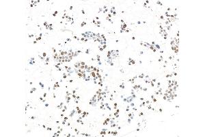 Immunocytochemistry (ICC) image for anti-Zinc Finger CCCH-Type Containing 4 (ZC3H4) (AA 1050-1100) antibody (ABIN7795760)