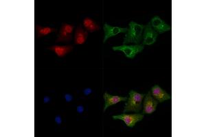 ABIN6266015 and ABIN6278800 staining Hela cells by IF/ICC. (MLL4 Antikörper  (C-Term))