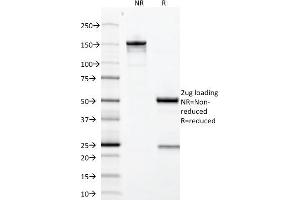 SDS-PAGE Analysis Purified Growth Hormone Mouse Monoclonal Antibody (GH/1371). (Growth Hormone 1 Antikörper  (AA 58-187))