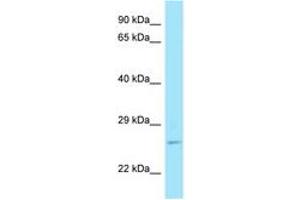 Image no. 1 for anti-RAB11A, Member RAS Oncogene Family (RAB11A) (C-Term) antibody (ABIN6748423) (RAB11A Antikörper  (C-Term))