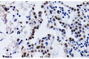 Immunohistochemistry (Paraffin-embedded Sections) (IHC (p)) image for anti-Inhibitor of DNA Binding 3, Dominant Negative Helix-Loop-Helix Protein (ID3) antibody (ABIN7261327)