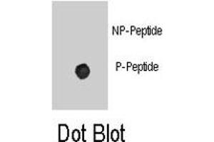 Dot blot analysis of ADRB2 (phospho S261) polyclonal antibody  on nitrocellulose membrane. (beta 2 Adrenergic Receptor Antikörper  (pSer261))