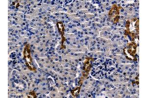 ABIN7094586 and ABIN7098635 at 1/100 staining mouse kidney tissue by IHC-P. (BCL9 Antikörper  (C-Term))