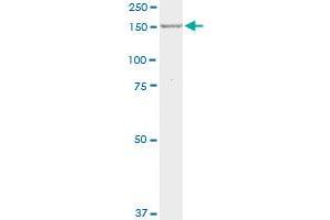 MPO monoclonal antibody (M01), clone 3E11. (Myeloperoxidase Antikörper  (AA 646-745))