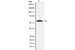 Western blot analysis of GGT1 expression in Human fetal liver lysate.