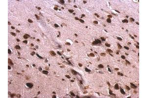 IHC-P Image Scaffold attachment factor B1 antibody detects Scaffold attachment factor B1 protein at nucleus on rat fore brain by immunohistochemical analysis. (SAFB Antikörper)