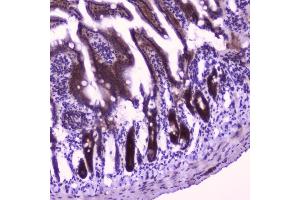 IHC analysis of FLIP using anti-FLIP antibody (ABIN5693075).