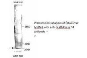 Image no. 1 for anti-Kallikrein 14 (KLK14) antibody (ABIN790854) (Kallikrein 14 Antikörper)