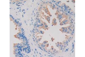 IHC-P analysis of Human Prostate Gland Tissue, with DAB staining. (HIF1AN Antikörper  (AA 2-349))
