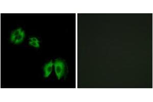 Immunofluorescence analysis of A549 cells, using B3GALT2 Antibody. (B3GALT2 Antikörper  (AA 373-422))