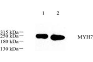 Western blot analysis of MYH7 (ABIN7075622),at dilution of 1: 500,Lane 1: Mouse heart tissue lysate,Lane 2: Rat muscle tissue lysate (Slow Skeletal Myosin Heavy Chain Antikörper)