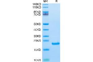 SDS-PAGE (SDS) image for Interleukin 21 (IL21) (AA 32-162) protein (His-Avi Tag,Biotin) (ABIN7274917)