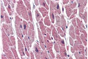 Human Heart (formalin-fixed, paraffin-embedded) stained with UNG antibody ABIN364332 at 10 ug/ml followed by biotinylated anti-mouse IgG secondary antibody ABIN481714, alkaline phosphatase-streptavidin and chromogen. (UNG Antikörper  (AA 1-313))