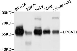 Western blot analysis of extracts of various cell lines, using LPCAT1 antibody. (LPCAT1 Antikörper)