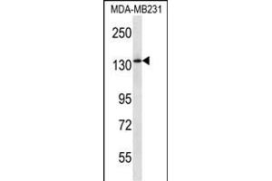 PIK3R4 Antibody (Center) (ABIN657232 and ABIN2837913) western blot analysis in MDA-M cell line lysates (35 μg/lane). (PIK3R4 Antikörper  (AA 819-847))