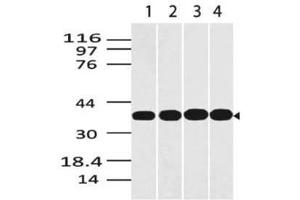 Image no. 1 for anti-Glyceraldehyde-3-Phosphate Dehydrogenase (GAPDH) (AA 120-320) antibody (ABIN5027214)
