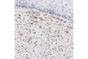 Immunohistochemical staining of human esophagus with SPARC polyclonal antibody  shows distinct positivity in fibroblasts. (SPARC Antikörper)