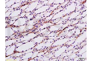 Formalin-fixed and paraffin embedded rat kidney tissue labeled with Anti-ENaCg/? (SCNN1G Antikörper  (AA 188-290))