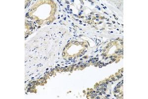 Immunohistochemistry of paraffin-embedded human prostate using STXBP2 antibody at dilution of 1:100 (x40 lens). (STXBP2 Antikörper)