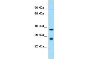 Host:  Rabbit  Target Name:  St8sia1  Sample Type:  Rat Heart lysates  Antibody Dilution:  1. (ST8SIA1 Antikörper  (Middle Region))