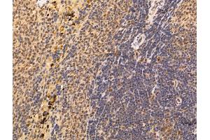 ABIN7094583 and ABIN7098632 at 1/100 staining Rat spleen tissue by IHC-P.