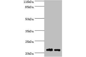 Western blot All lanes: NABP1 antibody at 2 μg/mL Lane 1: Hela whole cell lysate Lane 2: Jurkat whole cell lysate Secondary Goat polyclonal to rabbit IgG at 1/10000 dilution Predicted band size: 23, 14, 15 kDa Observed band size: 23 kDa