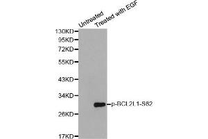 Western Blotting (WB) image for anti-BCL2-Like 1 (BCL2L1) (pSer62) antibody (ABIN1870015) (BCL2L1 Antikörper  (pSer62))