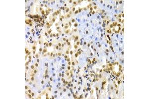 Immunohistochemistry of paraffin-embedded rat kidney using MAPK3 Antibody. (ERK1 Antikörper)