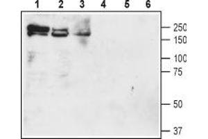Western blot analysis of rat brain membranes (lanes 1 and 4), mouse brain membranes (lanes 2 and 5) and rat lung lysate (lanes 3 and 6): - 1-3. (SLC12A2 Antikörper  (Intracellular))