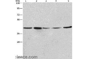 Western blot analysis of A549, NIH/3T3 and 293T cell? (RPSA/Laminin Receptor Antikörper)